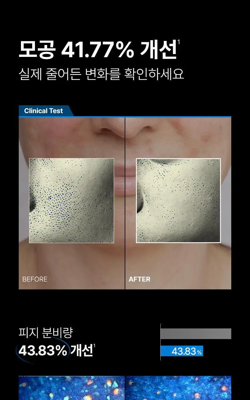 [모공 수, 모공부위 탄력개선, 300만 플라즈마 샷] 피캄 클리어 프로 상세페이지 13